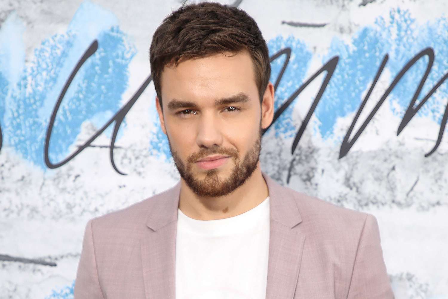 Liam Payne plastic surgery before and after Rumors details