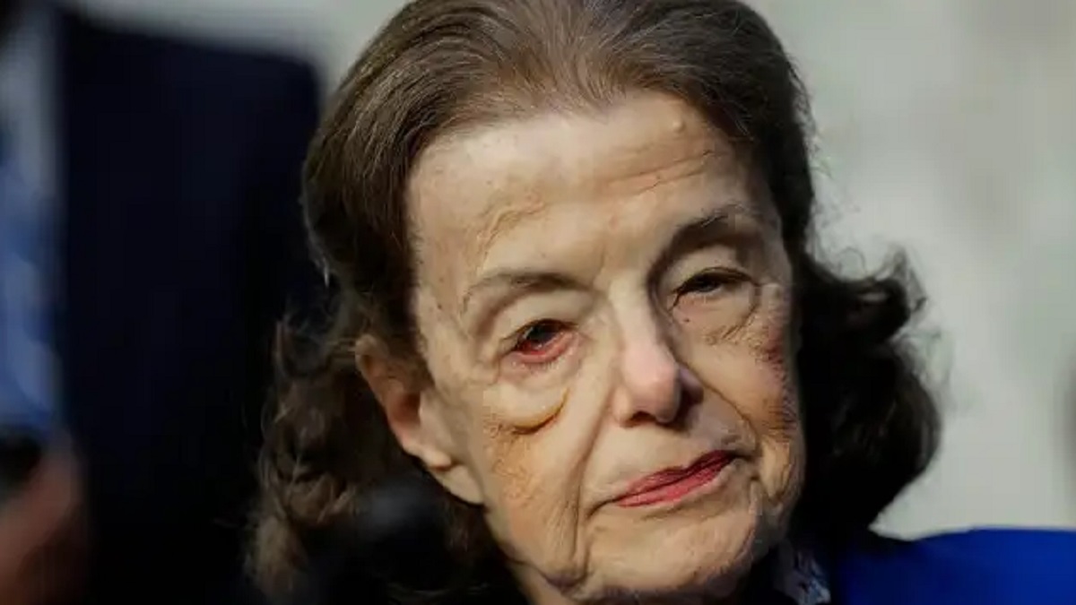 Diana Feinstein