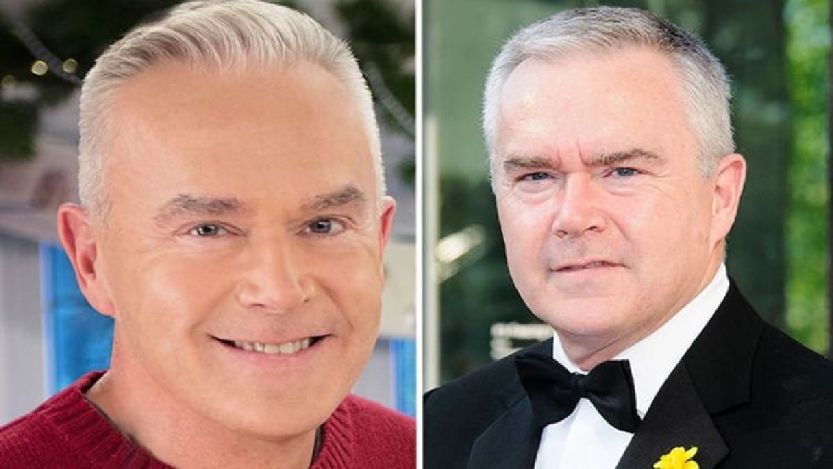 Before and after photographs of Huw Edwards's teeth