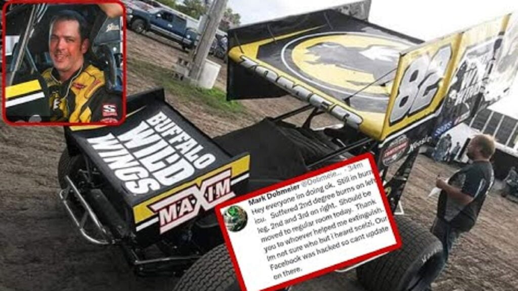 What Happened To Mark Dobmeier? Accident of American car driver injured