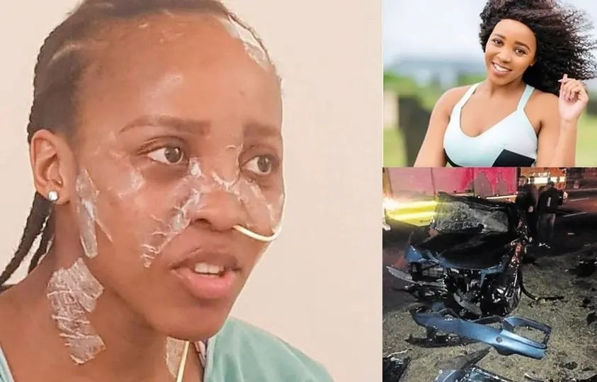Is Sbahle Mpisane permanently injured?