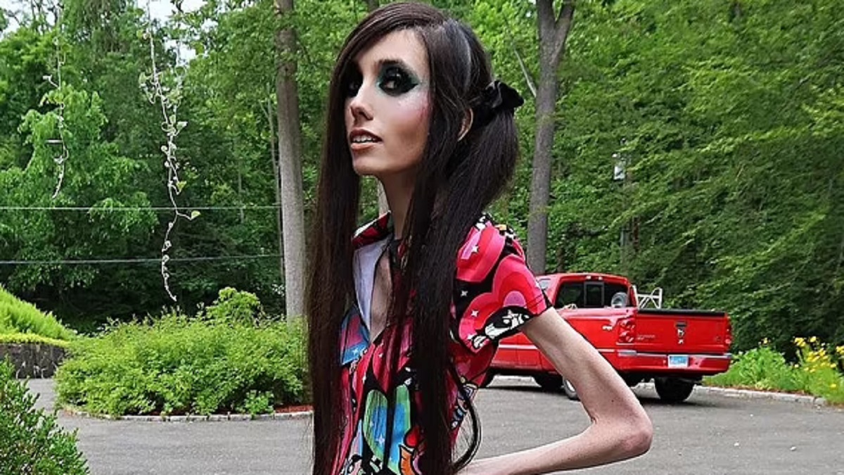 Anorexic YouTuber Eugenia Cooney