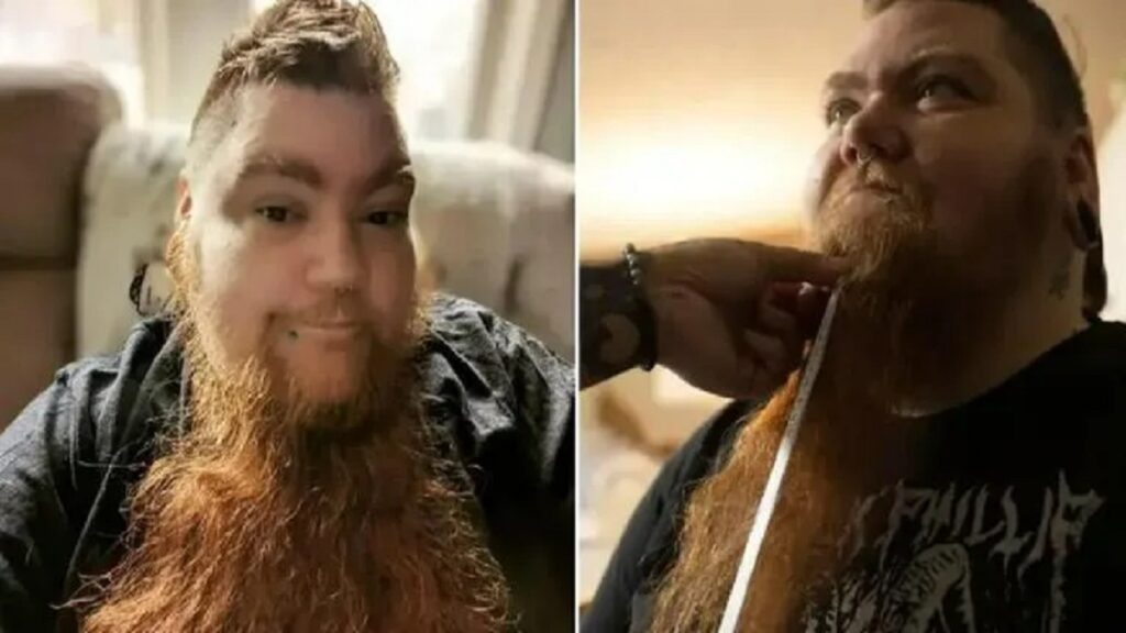Who Is Erin Honeycutt Meet Woman With The Longest Beard In The World 
