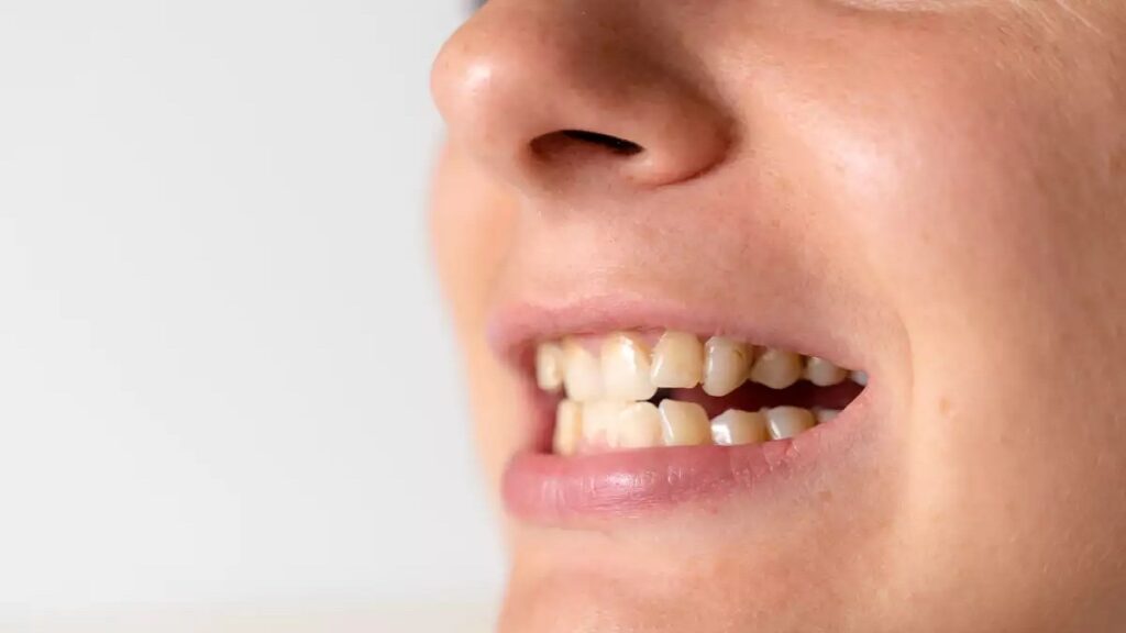 Regrow Teeth Clinical Trials World's 1st drug to regrow teeth enters